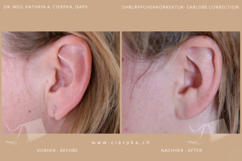 Pimp my... - Kleine Korrekturen, grosse Wirkung